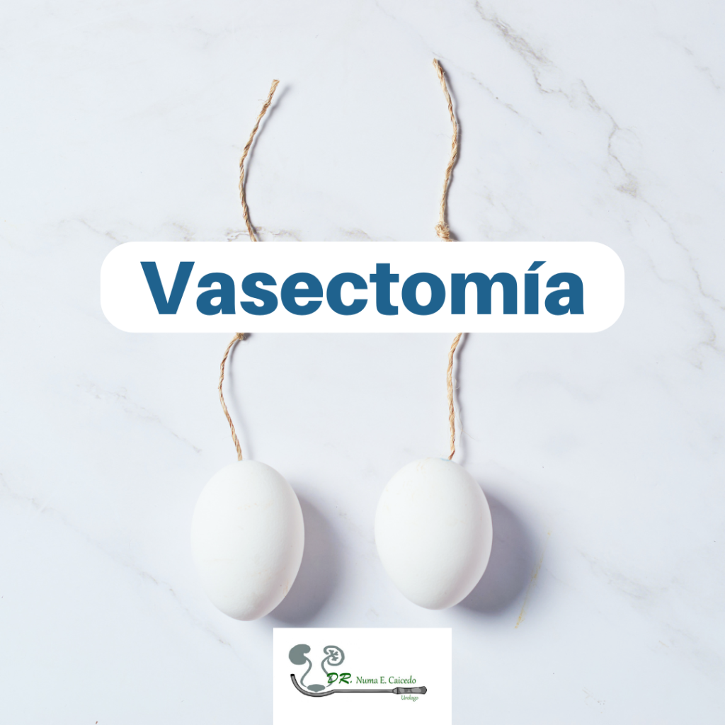 Vasectomia